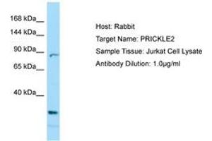 Image no. 1 for anti-Prickle Homolog 2 (PRICKLE2) (C-Term) antibody (ABIN6749993) (PRICKLE2 Antikörper  (C-Term))
