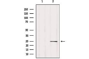 Western blot analysis of extracts from Mouse lung, using ARHGDIB Antibody. (ARHGDIB Antikörper  (N-Term))