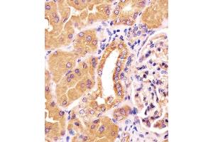 Antibody staining PCCA in human kidney tissue sections by Immunohistochemistry (IHC-P - paraformaldehyde-fixed, paraffin-embedded sections). (PCCA Antikörper  (AA 362-390))