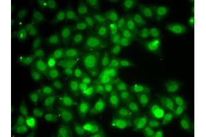 Immunofluorescence analysis of A549 cell using TRAF4 antibody. (TRAF4 Antikörper)