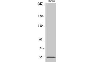 Western Blotting (WB) image for anti-Ets Variant 1 (ETV1) (N-Term) antibody (ABIN3174998) (ETV1 Antikörper  (N-Term))