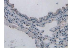 IHC-P analysis of Mouse Lung Tissue, with DAB staining. (Leptin Receptor Antikörper  (AA 22-203))