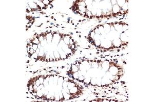 Immunohistochemistry of paraffin-embedded human colon using CDC16 Rabbit mAb (ABIN1678585, ABIN3017837, ABIN3017838 and ABIN7101525) at dilution of 1:100 (40x lens). (CDC16 Antikörper)
