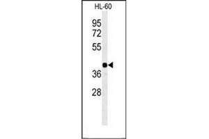 Western blot analysis of RGR Antibody  in HL-60 cell line lysates (35ug/lane). (RGR Antikörper  (Middle Region))