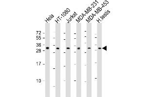 All lanes : Anti-SSX2 Antibody (Center) at 1:2000 dilution Lane 1: Hela whole cell lysates Lane 2: HT-1080 whole cell lysates Lane 3: Jurkat whole cell lysates Lane 4: MDA-MB-231 whole cell lysates Lane 5: MDA-MB-453 whole cell lysates Lane 6: human testis lysates Lysates/proteins at 20 μg per lane. (SSX2 Antikörper  (AA 110-142))