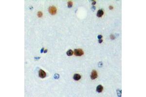 Immunohistochemical analysis of ICER staining in human brain formalin fixed paraffin embedded tissue section. (CREM Antikörper  (Center))