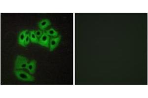 Immunofluorescence analysis of A549 cells, using VAMP4 (Ab-30) Antibody.
