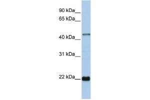 WB Suggested Anti-ZNF581 Antibody Titration:  0. (ZNF581 Antikörper  (Middle Region))