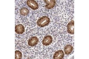 Immunohistochemical staining of human corpus, uterine with FAM122B polyclonal antibody  shows nuclear and cytoplasmic positivity in glandular cells at 1:200-1:500 dilution. (FAM122B Antikörper  (AA 11-132))