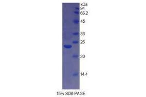 SDS-PAGE (SDS) image for HLA Class II DR alpha (HLA-DRA) (AA 26-216) protein (His tag) (ABIN1878858)
