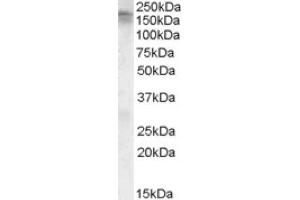 Image no. 1 for anti-Calcium Channel, Voltage-Dependent, L Type, alpha 1C Subunit (CACNA1C) (C-Term) antibody (ABIN375180) (CACNA1C Antikörper  (C-Term))