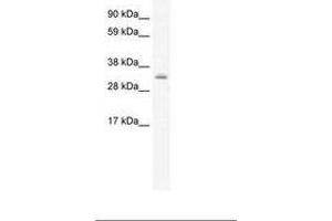 Image no. 1 for anti-PDZ and LIM Domain 1 (PDLIM1) (AA 165-214) antibody (ABIN202250) (PDLIM1 Antikörper  (AA 165-214))