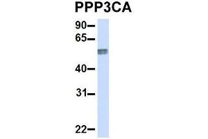 Western Blotting (WB) image for anti-Protein Phosphatase 3, Catalytic Subunit, alpha Isoform (PPP3CA) (Middle Region) antibody (ABIN2784524)