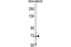 Western Blotting (WB) image for anti-Grainyhead-Like 2 (GRHL2) antibody (ABIN2997171) (GRHL2 Antikörper)