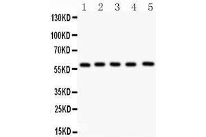 Western Blotting (WB) image for anti-Nuclear Receptor Subfamily 5, Group A, Member 2 (NR5A2) (AA 44-237) antibody (ABIN3043579)