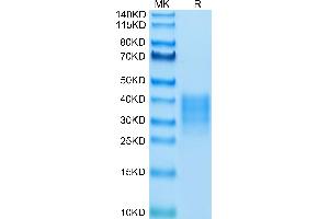 FAS Protein (AA 26-173) (His tag)