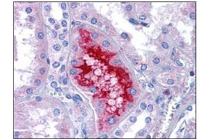 Human Kidney: Formalin-Fixed, Paraffin-Embedded (FFPE) (MATN1 Antikörper  (C-Term))