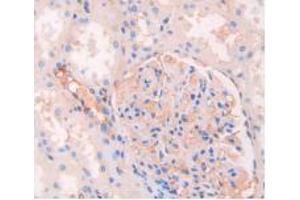 IHC-P analysis of Human Kidney Tissue, with DAB staining. (Kaninchen anti-Human IgG4 (AA 222-327) Antikörper)