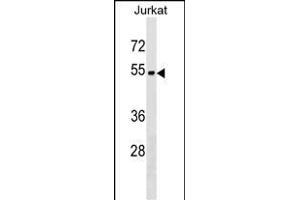 ZN Antibody (Center) (ABIN1538123 and ABIN2849842) western blot analysis in Jurkat cell line lysates (35 μg/lane). (ZNF703 Antikörper  (AA 226-254))