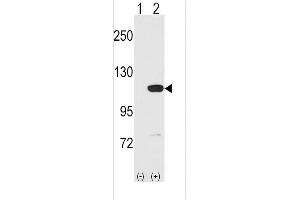 Western blot analysis of MVP using rabbit polyclonal MVP C-term Antibody using 293 cell lysates (2 ug/lane) either nontransfected (Lane 1) or transiently transfected with the MVP gene (Lane 2). (MVP Antikörper  (C-Term))