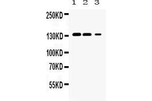 Western blot analysis of JAK1 expression in rat kidney extract ( Lane 1), mouse kidney extract ( Lane 2) and HELA whole cell lysates ( Lane 3).