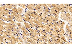 Detection of TLR2 in Porcine Cardiac Muscle Tissue using Polyclonal Antibody to Toll Like Receptor 2 (TLR2) (TLR2 Antikörper  (AA 47-245))
