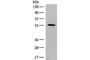 Western blot analysis of HepG2 cell lysate using GPR22 Polyclonal Antibody at dilution of 1:500 (GPR22 Antikörper)