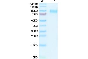 Mouse M-CSF R/CSF1R/CD115 on Tris-Bis PAGE under reduced condition. (CSF1R Protein (AA 20-511) (His tag))