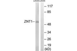 Western blot analysis of extracts from LOVO cells, using SLC30A1 Antibody. (SLC30A1 Antikörper  (AA 201-250))