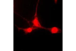Immunofluorescent analysis of STAT5A (pS780) staining in HepG2 cells. (STAT5A Antikörper  (C-Term, pSer780))