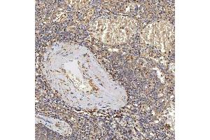 IHC analysis of SUCLG2 using anti-SUCLG2 antibody (ABIN7601694). (SUCLG2 Antikörper  (AA 42-424))