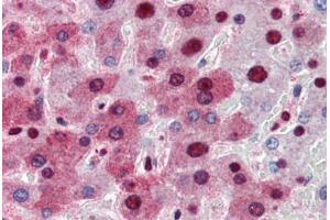 Human Liver (formalin-fixed, paraffin-embedded) stained with NPM1 antibody ABIN364324 at 5 ug/ml followed by biotinylated anti-mouse IgG secondary antibody ABIN481714, alkaline phosphatase-streptavidin and chromogen. (NPM1 Antikörper  (AA 81-294))