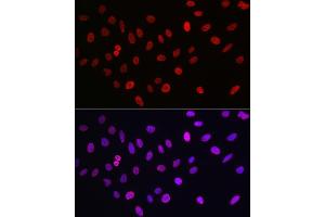 Immunofluorescence analysis of U2OS cells using MonoMethyl-Histone H3-K9 Rabbit mAb (ABIN7267685) at dilution of 1:100 (40x lens).
