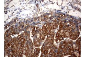 Image no. 1 for anti-3-Oxoacyl-ACP Synthase, Mitochondrial (OXSM) (AA 78-343) antibody (ABIN1491676) (OXSM Antikörper  (AA 78-343))