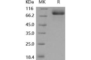 MEP1A Protein (His tag)