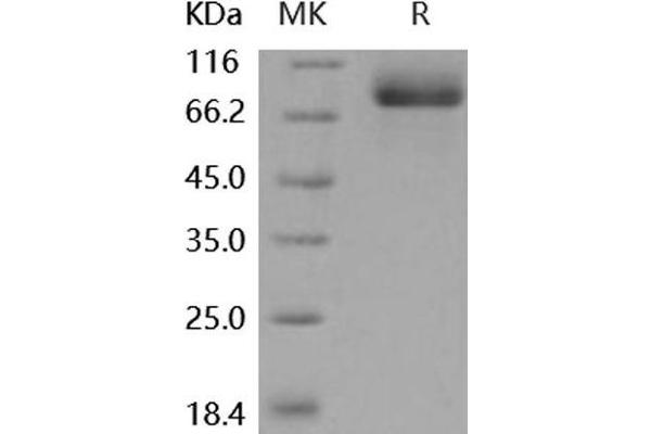 MEP1A Protein (His tag)