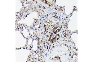 Immunohistochemistry (IHC) image for anti-Gelsolin (GSN) (AA 543-782) antibody (ABIN7267365)