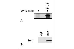 Immunostaining of Brg1 by BRG-01 antibody. (SMARCA4 Antikörper  (C-Term))