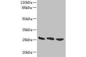 Western blot All lanes: DNAJB8 antibody at 8 μg/mL Lane 1: Hela whole cell lysate Lane 2: Mouse brain tissue Lane 3: Mouse liver tissue Secondary Goat polyclonal to rabbit IgG at 1/10000 dilution Predicted band size: 26 kDa Observed band size: 26 kDa (DNAJB8 Antikörper  (AA 1-232))