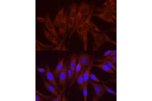 Immunofluorescence analysis of NIH/3T3 cells using NUMB Rabbit pAb (ABIN6129424, ABIN6144943, ABIN6144944 and ABIN6224990) at dilution of 1:250 (40x lens). (NUMB Antikörper  (AA 521-640))