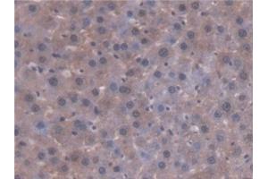 Detection of AT in Rat Liver Tissue using Polyclonal Antibody to Antithrombin (AT) (SERPINC1 Antikörper  (AA 33-465))