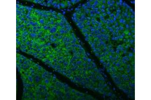 IF analysis of Citrin/SLC25A13 using anti-Citrin/SLC25A13 antibody (ABIN7599512). (slc25a13 Antikörper  (AA 1-643))