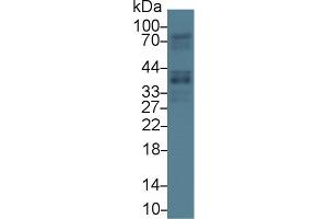 Western Blot; Sample: Human Lung lysate; Primary Ab: 1µg/ml Rabbit Anti-Human GAS2 Antibody Second Ab: 0.