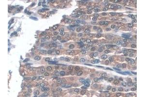 Immunohistochemistry (IHC) image for anti-Glutathione Peroxidase 3 (Plasma) (GPX3) (AA 3-72) antibody (ABIN7443332)