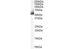 ABIN185508 (0. (MDM2 Antikörper  (Internal Region))