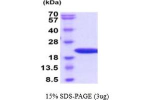 SDS-PAGE (SDS) image for Peptidylprolyl Cis/trans Isomerase, NIMA-Interacting 1 (PIN1) (AA 1-165) (Active) protein (His tag) (ABIN6388010)