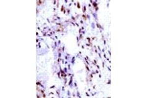 Immunohistochemical analysis of IGF2 expression in human ovarian vascular endothelial cells. (IGF2 Antikörper  (C-Term))