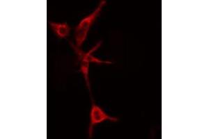 ABIN6274808 staining COLO205 cells by IF/ICC. (LYPLA1 Antikörper  (Internal Region))