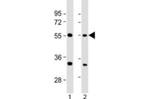Western blot testing of human 1) 293T/17 and 2) HeLa cell lysate with AAAS antibody at 1:2000.