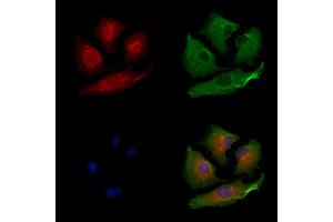 ABIN6264206 and ABIN6279656 staining  cells by IF/ICC.